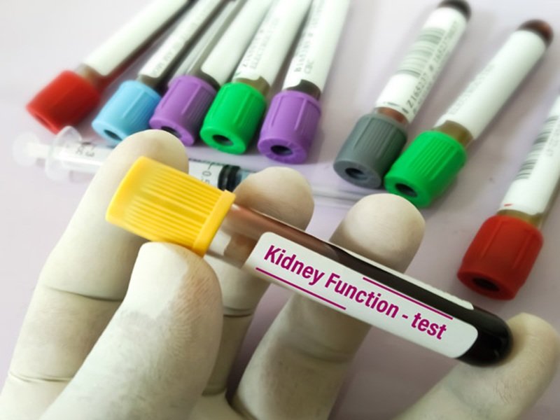 Kidney Function Tests