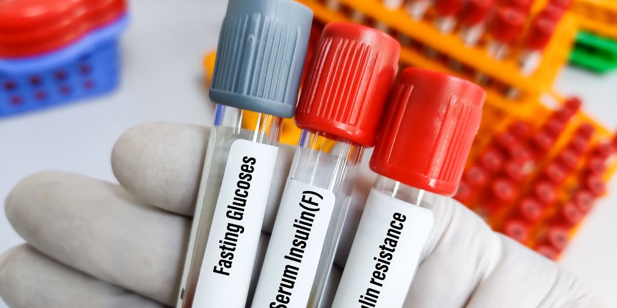Book Fasting Plasma Glucose Test (ఫాస్టింగ్ ప్లాస్మా గ్లూకోజ్)