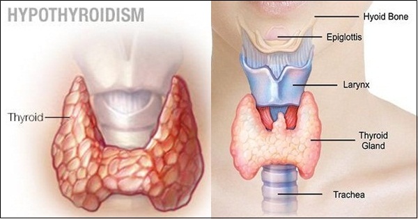 Book Thyroid Profile Test (థైరాయిడ్ ప్రొఫైల్)