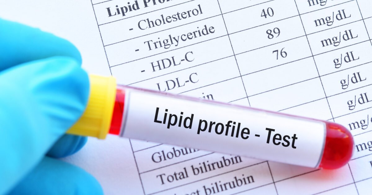 Lipid Profile (లిపిడ్ ప్రొఫైల్ )