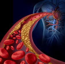 Book Lipid Profile Test (లిపిడ్ ప్రొఫైల్)