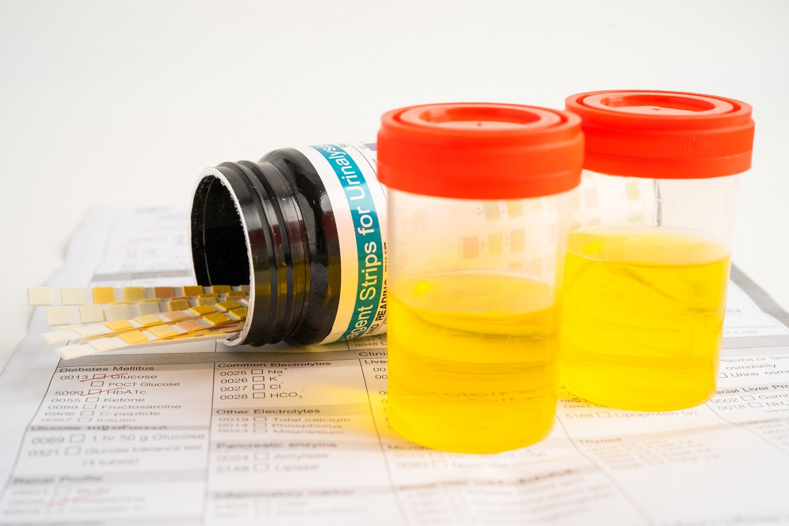 Book Complete Urine Examination (CUE) Test (కంప్లీట్ యూరిన్ ఎగ్జామినేషన్ )