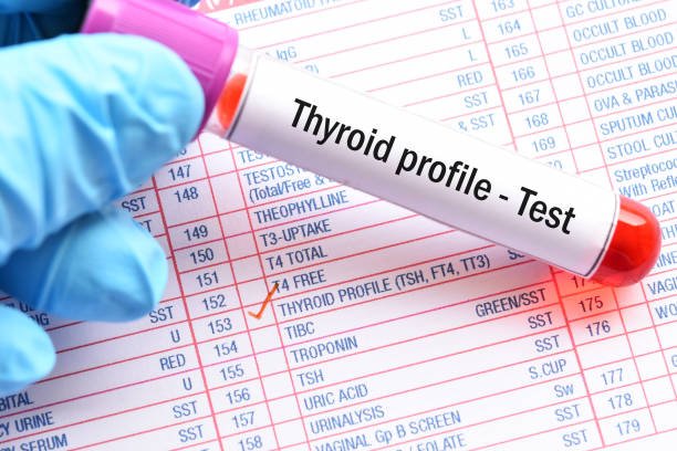 Thyroid Profile (థైరాయిడ్ ప్రొఫైల్)