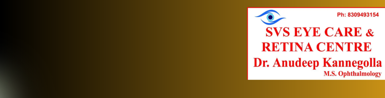 Store Banner